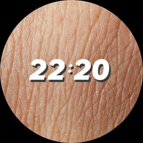 Dermis 2