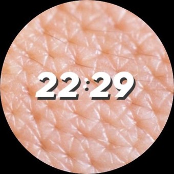 Dermis 6
