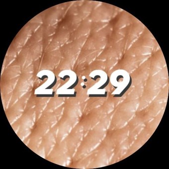 Dermis 7