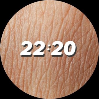 Dermis 2